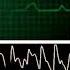 Hospital Monitor With FlatLine L HD