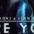 Steve Aoki Alan Walker Are You Lonely Feat ISÁK Steve Aoki Remix