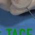 Selective TACE With Occlusafe Balloon