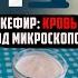 Кровь под микроскопом после Кефира