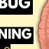 How To Tell If You Have A Stomach Bug Or Food Poisoning A Complete Guide