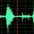 Crackles Pulmonary Edema