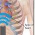 EFAST For EMS Appendix G Subxiphoid Pericardial View