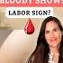 Bloody Show Is It A Sure Sign Of Labor