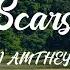 I AM THEY Scars Lyrics So Forever I Am Thankful For The Scars